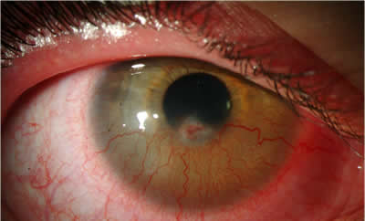 External and anterior segment examination